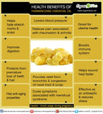 Benefits of Frankincense